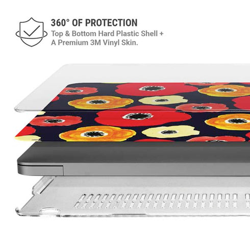 Bouffants and Broken Hearts Anemone Flower MacBook Pro 14in (2021-24) Case plus Skin