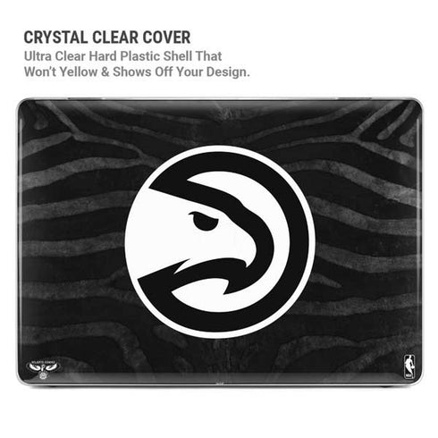 NBA Atlanta Hawks Black Animal Print MacBook Pro 14in (2021-24) Case plus Skin