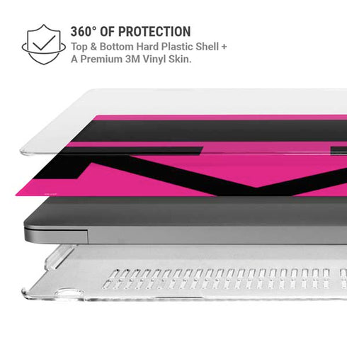 Black and Pink Arrows MacBook Pro 14in (2021-24) Case plus Skin