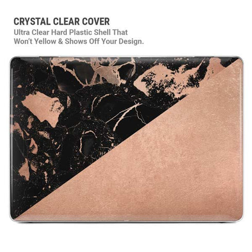 Black and Rose Gold Marble Split MacBook Pro 14in (2021-24) Case plus Skin