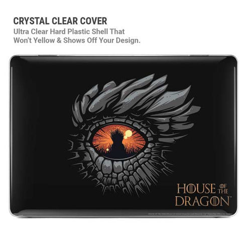 HBO House of the Dragon Burning Dragon MacBook Cases