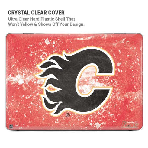 NHL Calgary Flames Frozen MacBook Pro 14in (2021-24) Case plus Skin