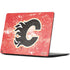 NHL Calgary Flames Frozen Surface Laptop 7 15in Skin