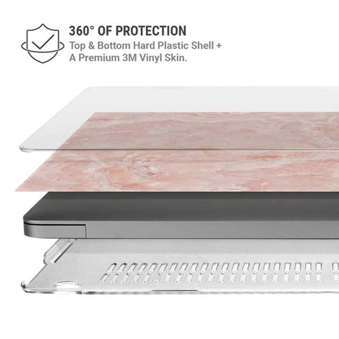 Crystal Pink MacBook Pro 14in (2021-24) Case plus Skin