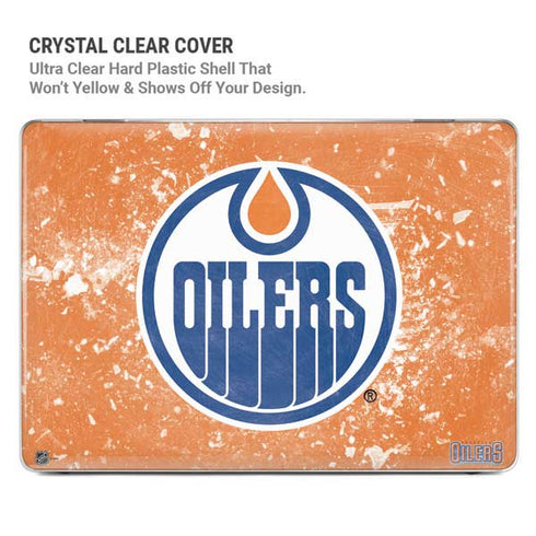 NHL Edmonton Oilers Frozen MacBook Pro 14in (2021-24) Case plus Skin