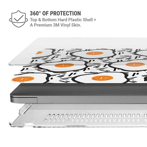 Bouffants and Broken Hearts Eggs MacBook Pro 14in (2021-24) Case plus Skin