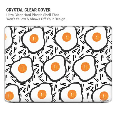 Bouffants and Broken Hearts Eggs MacBook Cases