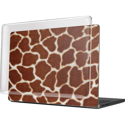 Giraffe MacBook Pro 14in (2021-24) Case plus Skin