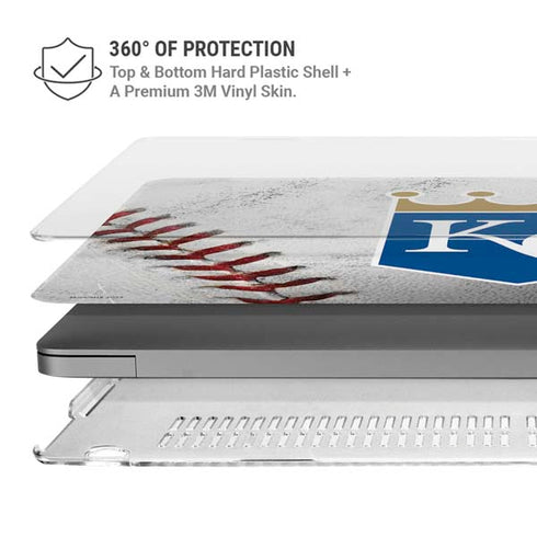 MLB Kansas City Royals Game Ball MacBook Pro 14in (2021-24) Case plus Skin
