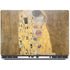 Klimt - The Kiss by Klimt Dell Precision Skin
