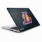 NBA Los Angeles Lakers Secondary Logo HP Elitebook Skin