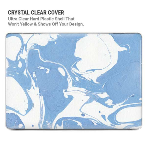 Marbleized Blue MacBook Pro 14in (2021-24) Case plus Skin