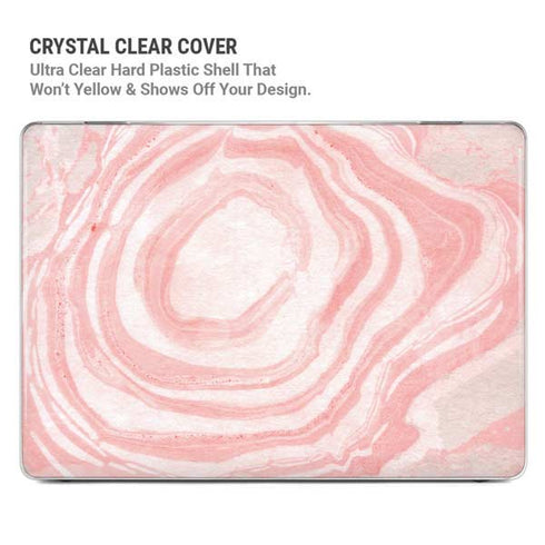 Marbleized Pink MacBook Pro 14in (2021-24) Case plus Skin