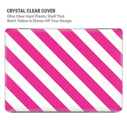 Pink and White Geometric Stripes MacBook Pro 14in (2021-24) Case plus Skin
