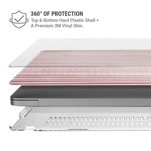 Pink and White Stripes MacBook Pro 14in (2021-24) Case plus Skin