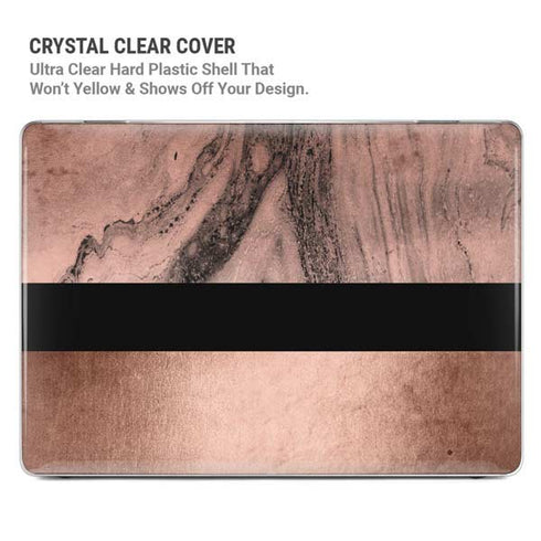 Rose Gold and Black Marble MacBook Pro 14in (2021-24) Case plus Skin