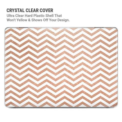 Rose Gold Chevron MacBook Pro 14in (2021-24) Case plus Skin