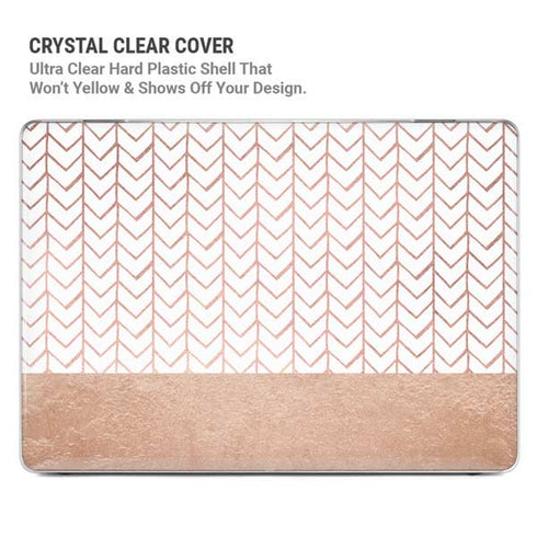 Rose Gold Herringbone MacBook Pro 14in (2021-24) Case plus Skin