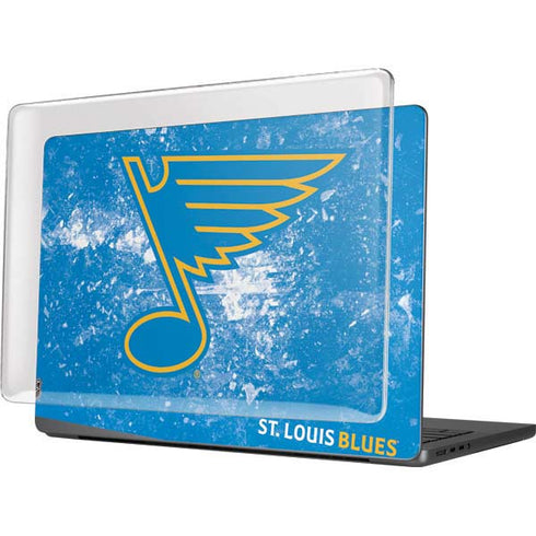 NHL St. Louis Blues Iced MacBook Pro 14in (2021-24) Case plus Skin