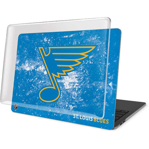 NHL St. Louis Blues Iced MacBook Pro 15in (2016-19) Case plus Skin
