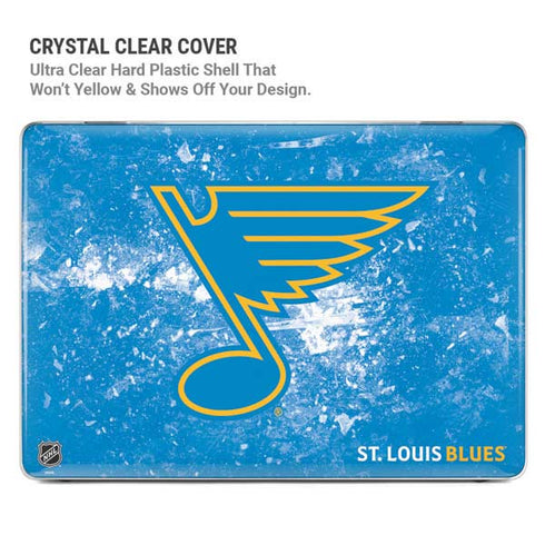 NHL St. Louis Blues Iced MacBook Pro 16in (2019-20) Case plus Skin