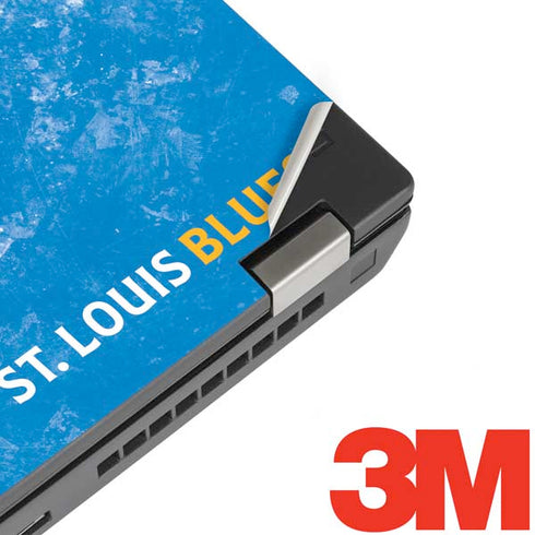 NHL St. Louis Blues Iced Lenovo ThinkPad Skin