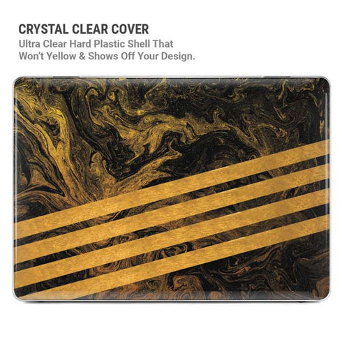 Striped Marble MacBook Pro 14in (2021-24) Case plus Skin