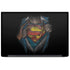 DC Comics Superman Pastel Art Dell Latitude Skin