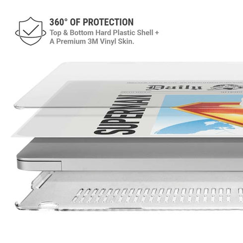 Superman 2025 Daily Planet Superman Cover MacBook Pro 15in (2016-19) Case plus Skin