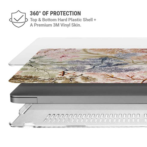 Textile Design by William Kilburn MacBook Pro 14in (2021-24) Case plus Skin