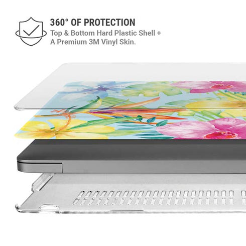 Tropical Daze MacBook Cases
