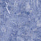 Crushed Blue Wii (Includes 1 Controller) Skin