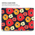 Bouffants and Broken Hearts Anemone Flower MacBook Pro 16in (2021-25) Case plus Skin