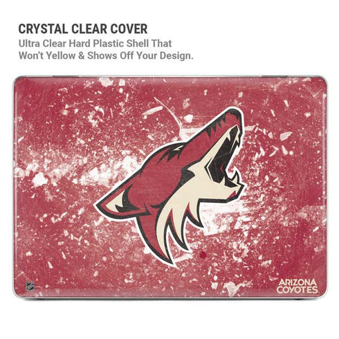NHL Arizona Coyotes Frozen MacBook Pro 16in (2021-25) Case plus Skin