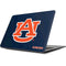 Auburn University Logo Blue Apple MacBook Skin