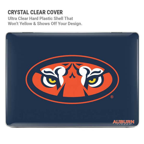 Auburn University Tigers Mascot MacBook Pro 16in (2021-25) Case plus Skin