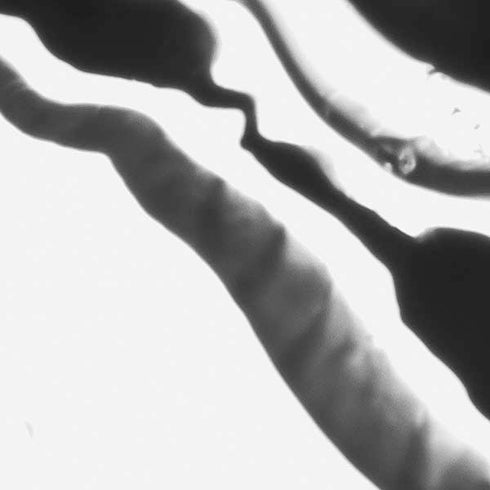 Black Marble Ink Moto E5 Play Skin