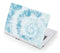 Blue and White Tie Dye Acer Chromebook Skin