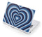 Blue Heart Pattern Acer Chromebook Skin