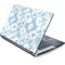 Blue Tie Dye Generic Laptop Skin