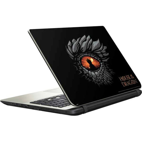 HBO House of the Dragon Burning Dragon Satellite L50-B / S50-B Skin