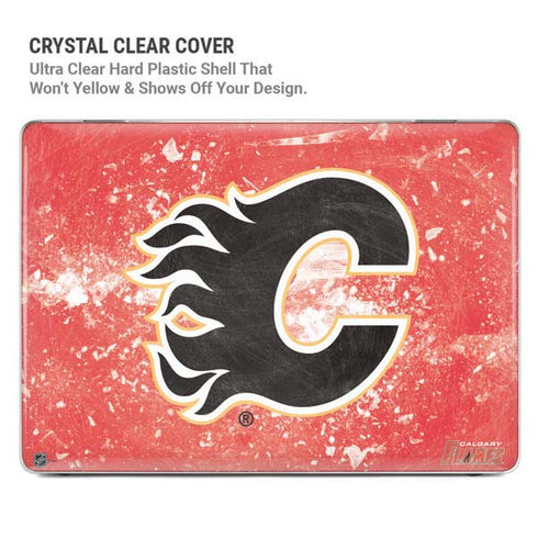 NHL Calgary Flames Frozen MacBook Pro 13in (2020) Case plus Skin