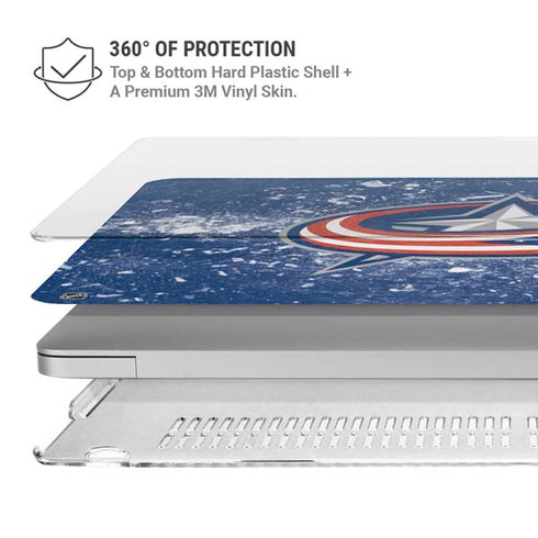 NHL Columbus Blue Jackets Frozen MacBook Air 13in M1 (2021) Case plus Skin