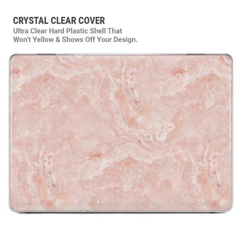 Crystal Pink MacBook Air 13in M1 (2021) Case plus Skin