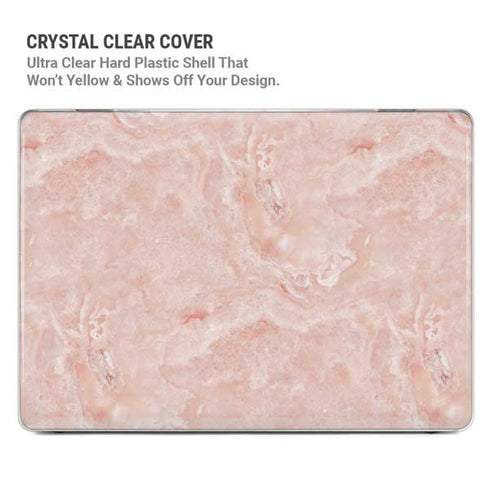 Crystal Pink MacBook Pro 16in (2021-25) Case plus Skin