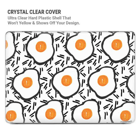 Bouffants and Broken Hearts Eggs MacBook Air 13in M1 (2021) Case plus Skin