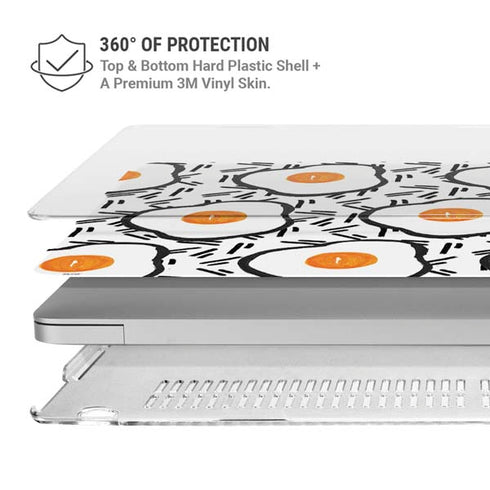 Bouffants and Broken Hearts Eggs MacBook Pro 13in (2020) Case plus Skin
