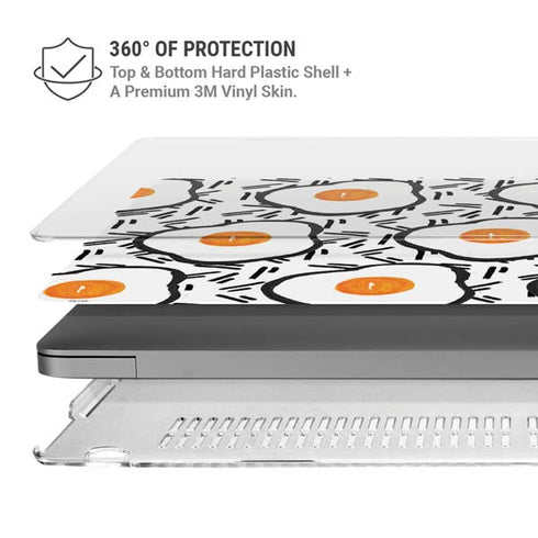 Bouffants and Broken Hearts Eggs MacBook Pro 16in (2021-25) Case plus Skin