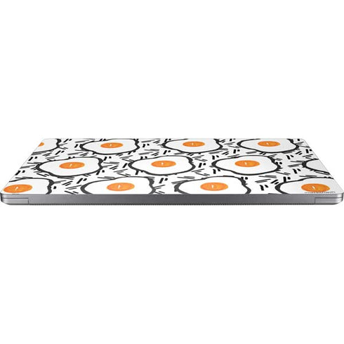 Bouffants and Broken Hearts Eggs Universal Laptop 11in (8.8 x 6.2in) Skin