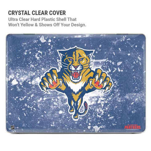 NHL Florida Panthers Frozen MacBook Air 13in M1 (2021) Case plus Skin